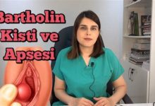 Bartholin Kisti Nedir? Tedavisi Nasıl Yapılır?