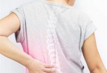 Kadınlarda Osteoporoz: Risk Faktörleri ve Önleme Yöntemleri