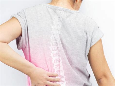 Kadınlarda Osteoporoz: Risk Faktörleri ve Önleme Yöntemleri